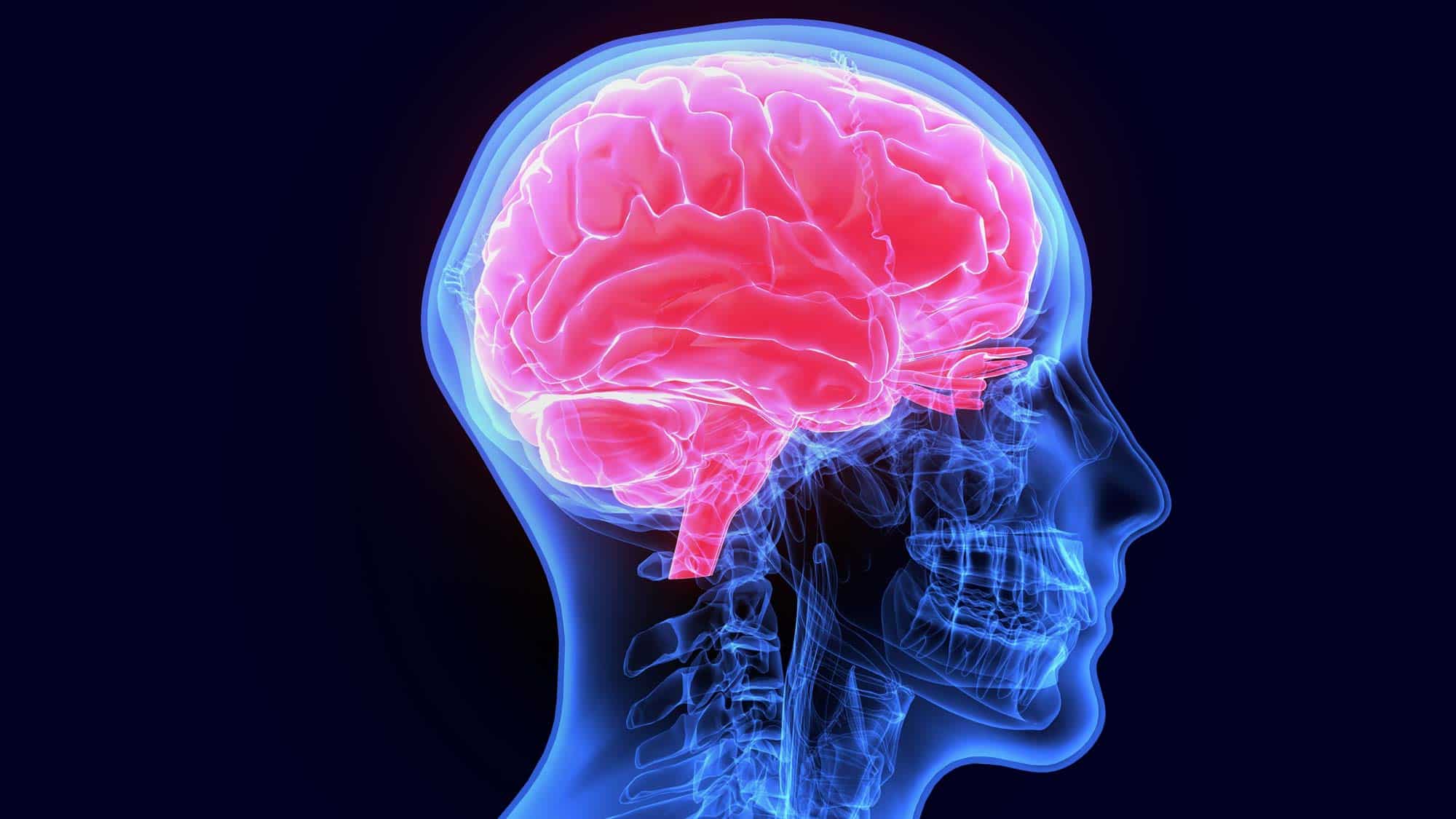 Gehirnaufnahme von CFS Kopf